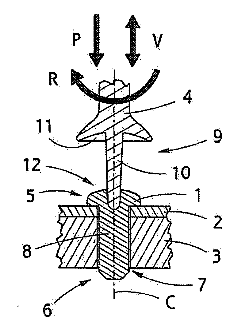 Implant, implantation tool, kit and method