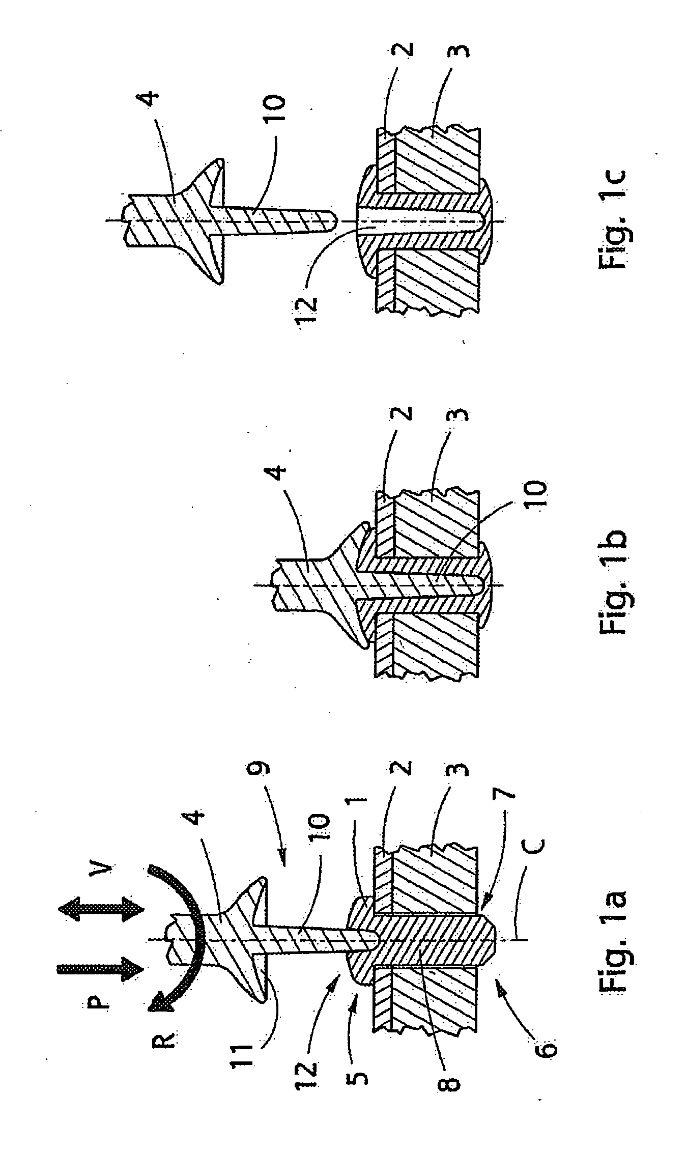 Implant, implantation tool, kit and method