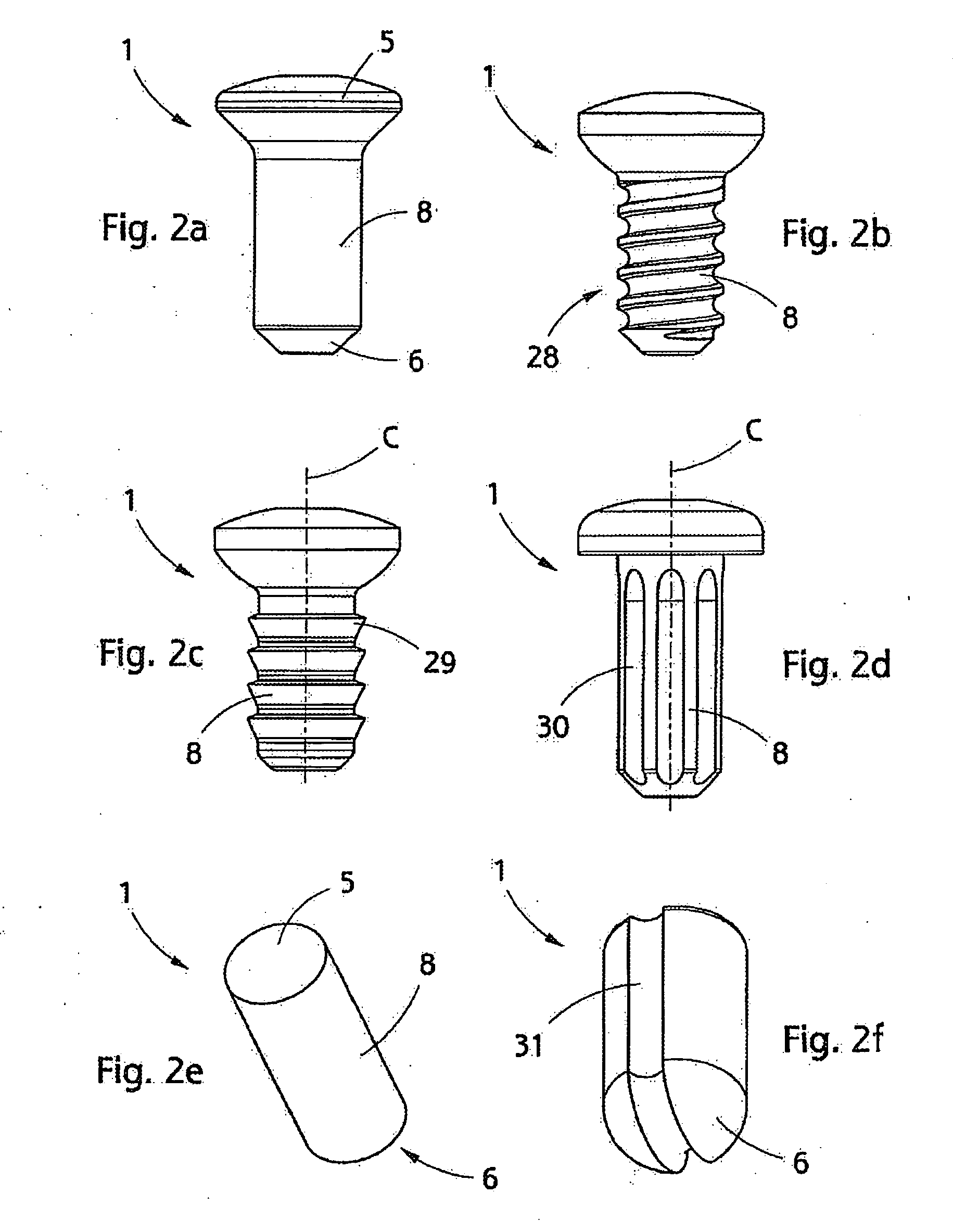 Implant, implantation tool, kit and method