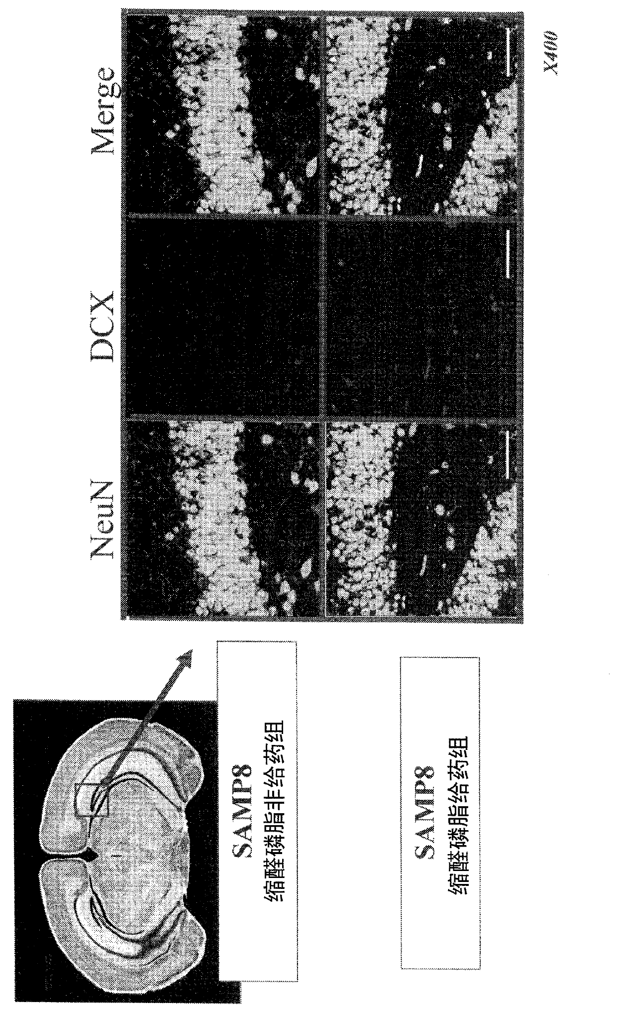 Cerebral nerve cell neogenesis agent