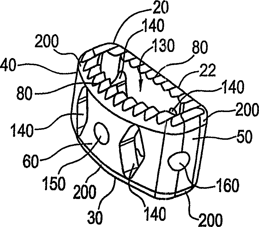 Spinal fusion implant