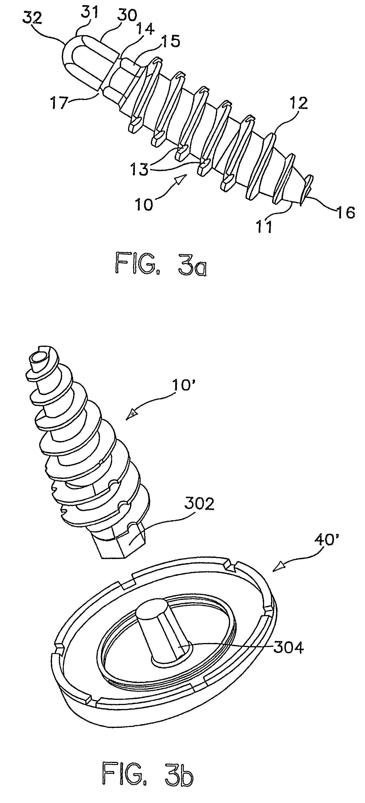 System and method for joint resurface repair