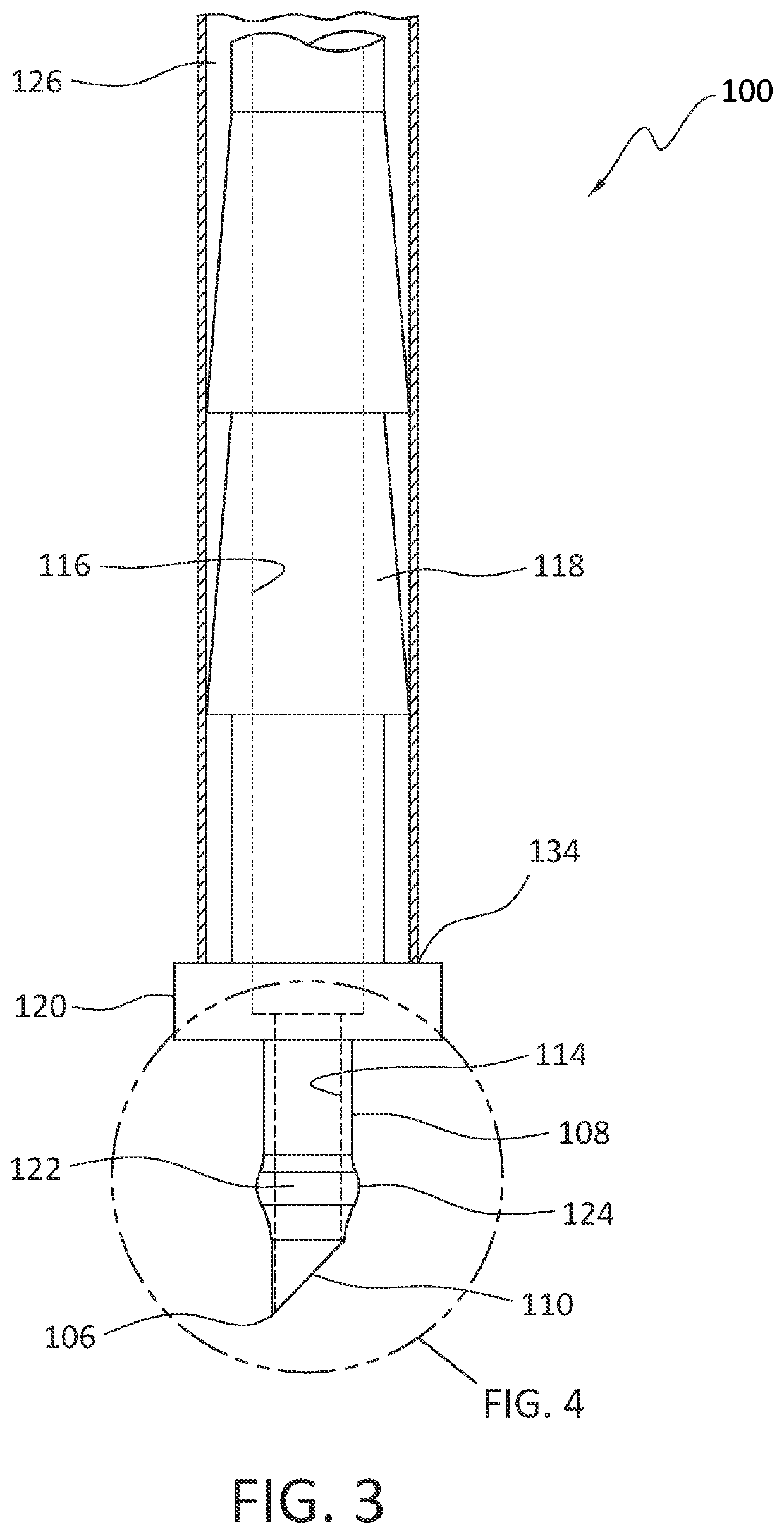 Anterior chamber maintainer (ACM)