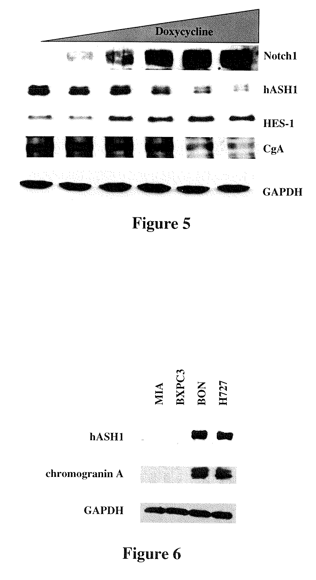 Modulating notch1 signaling pathway for treating neuroendocrine tumors