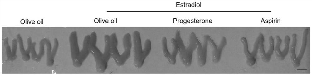 Application of aspirin in preparation of medicine for treating endometrial hyperplasia