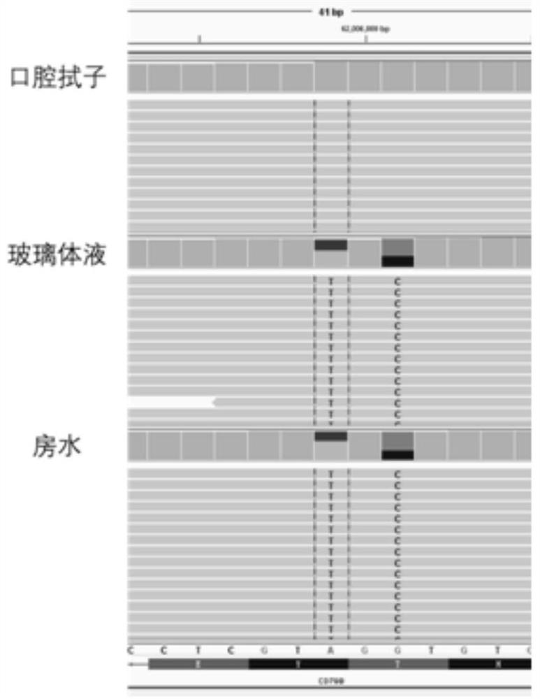 Extraction method and kit of aqueous humor cfDNA and application of aqueous humor cfDNA in PVRL clinical auxiliary examination