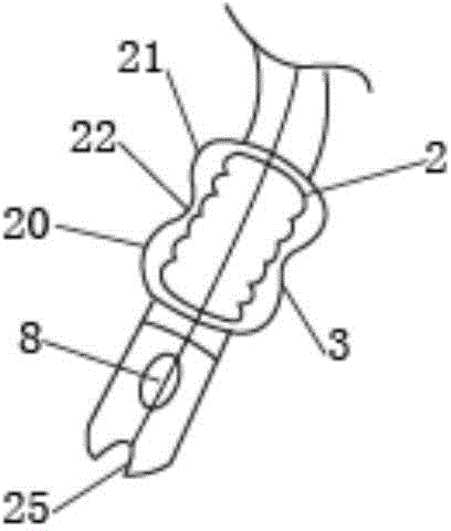 Multifunctional double-bag trachea cannula