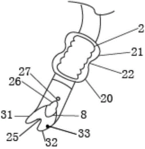 Multifunctional double-bag trachea cannula