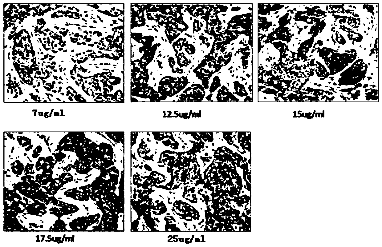 Kit for detecting ER-alpha 36 expression level in tumour tissue