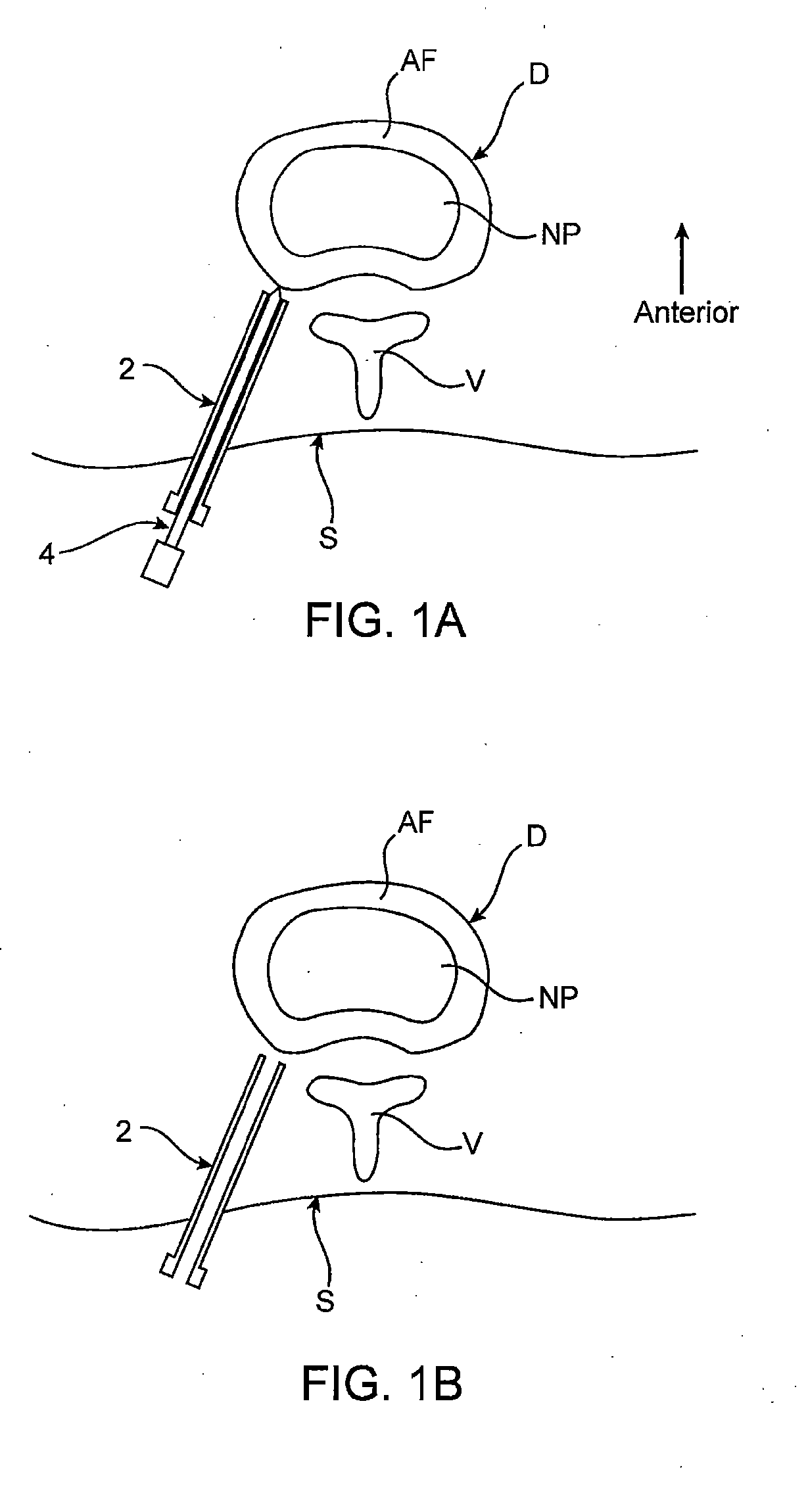 Spinal diagnostic methods and apparatus