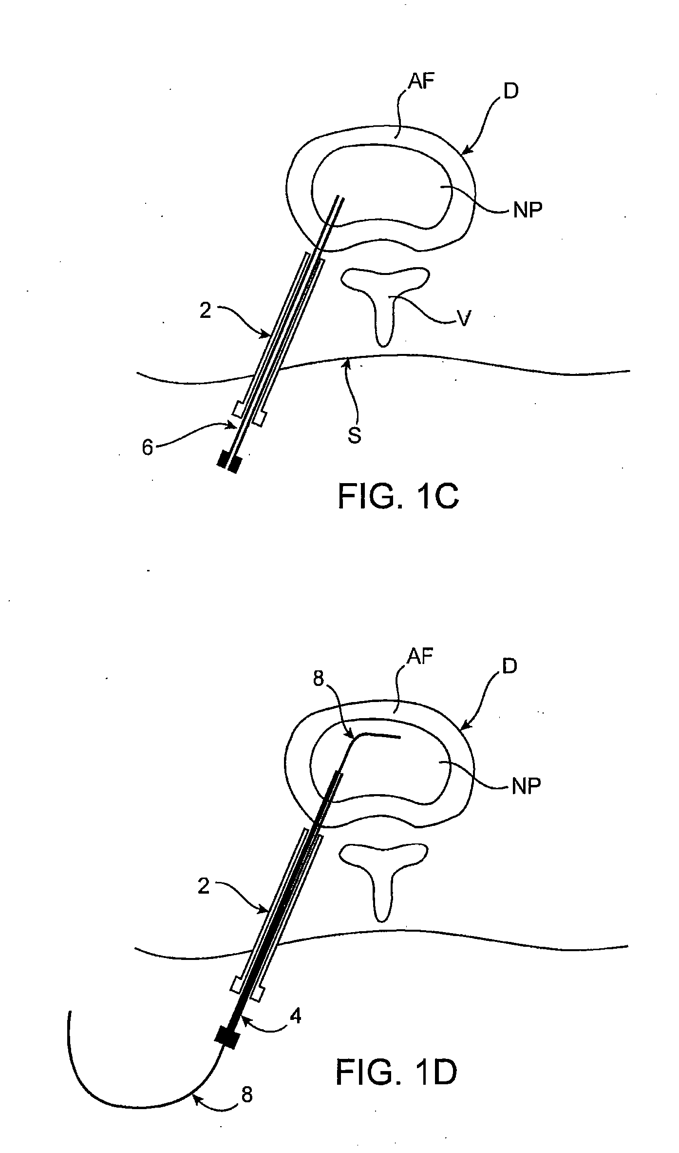 Spinal diagnostic methods and apparatus