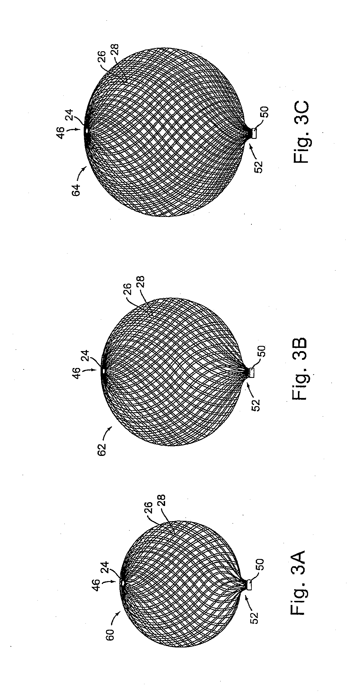 Methods For Making Braid-Ball Occlusion Devices