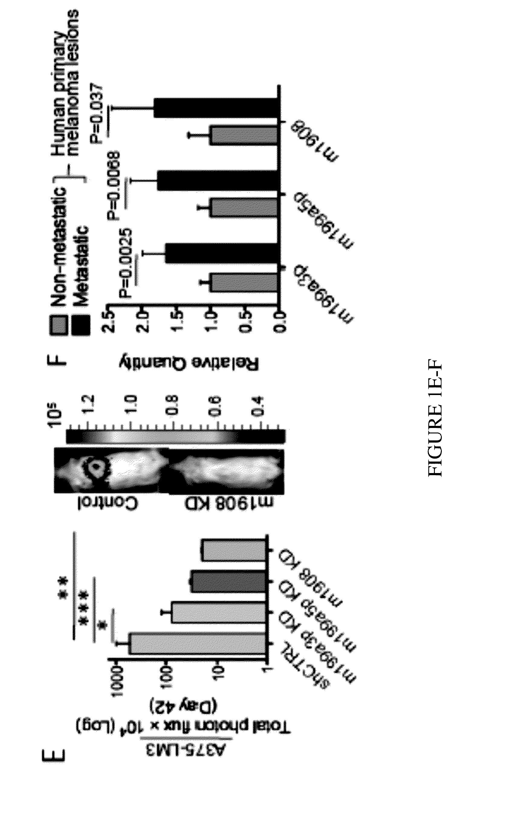 Treatment and Diagnosis of Melanoma