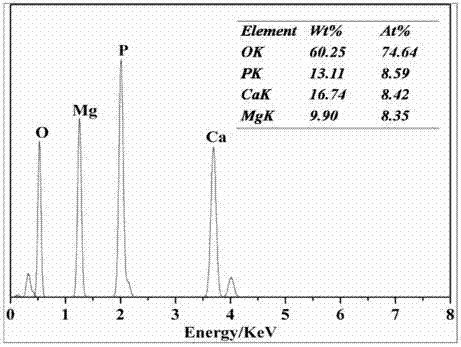 Degradable rare earth magnesium alloy medical biomaterial and preparation method thereof