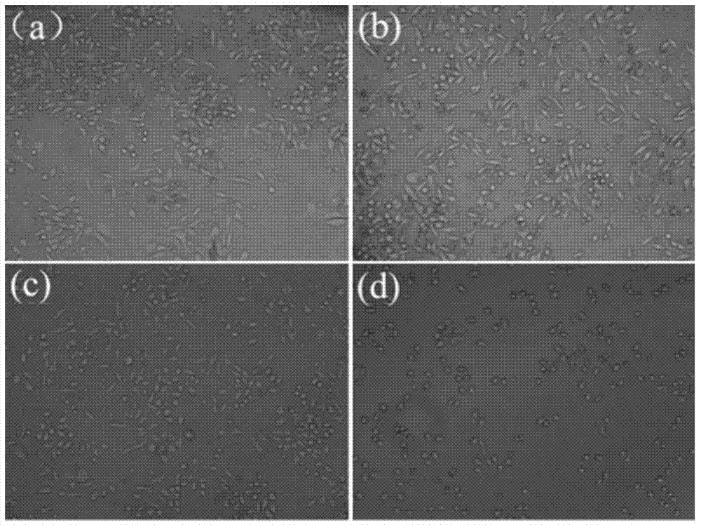 Degradable rare earth magnesium alloy medical biomaterial and preparation method thereof