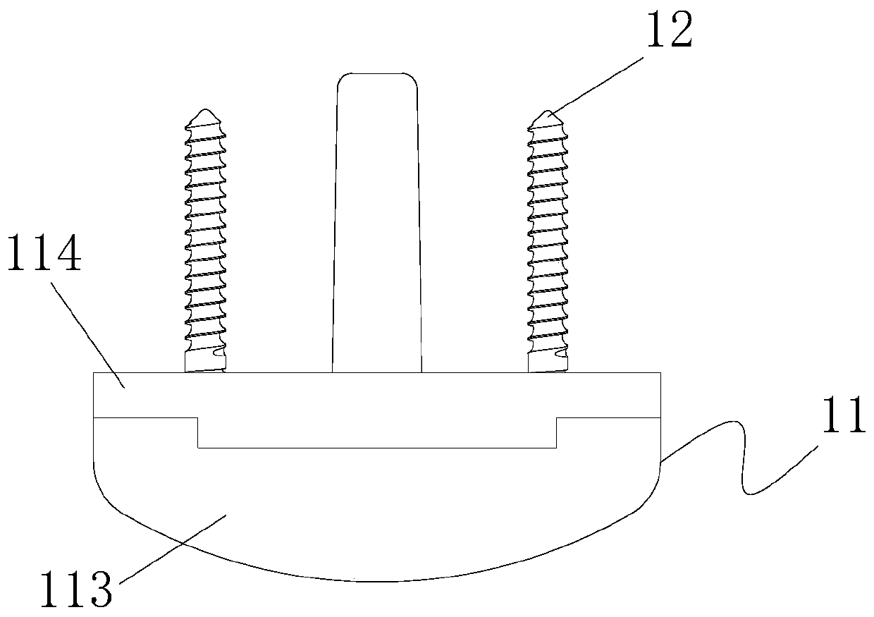 Wrist joint prosthesis