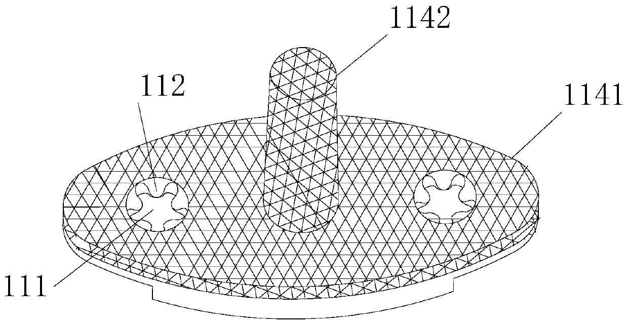 Wrist joint prosthesis