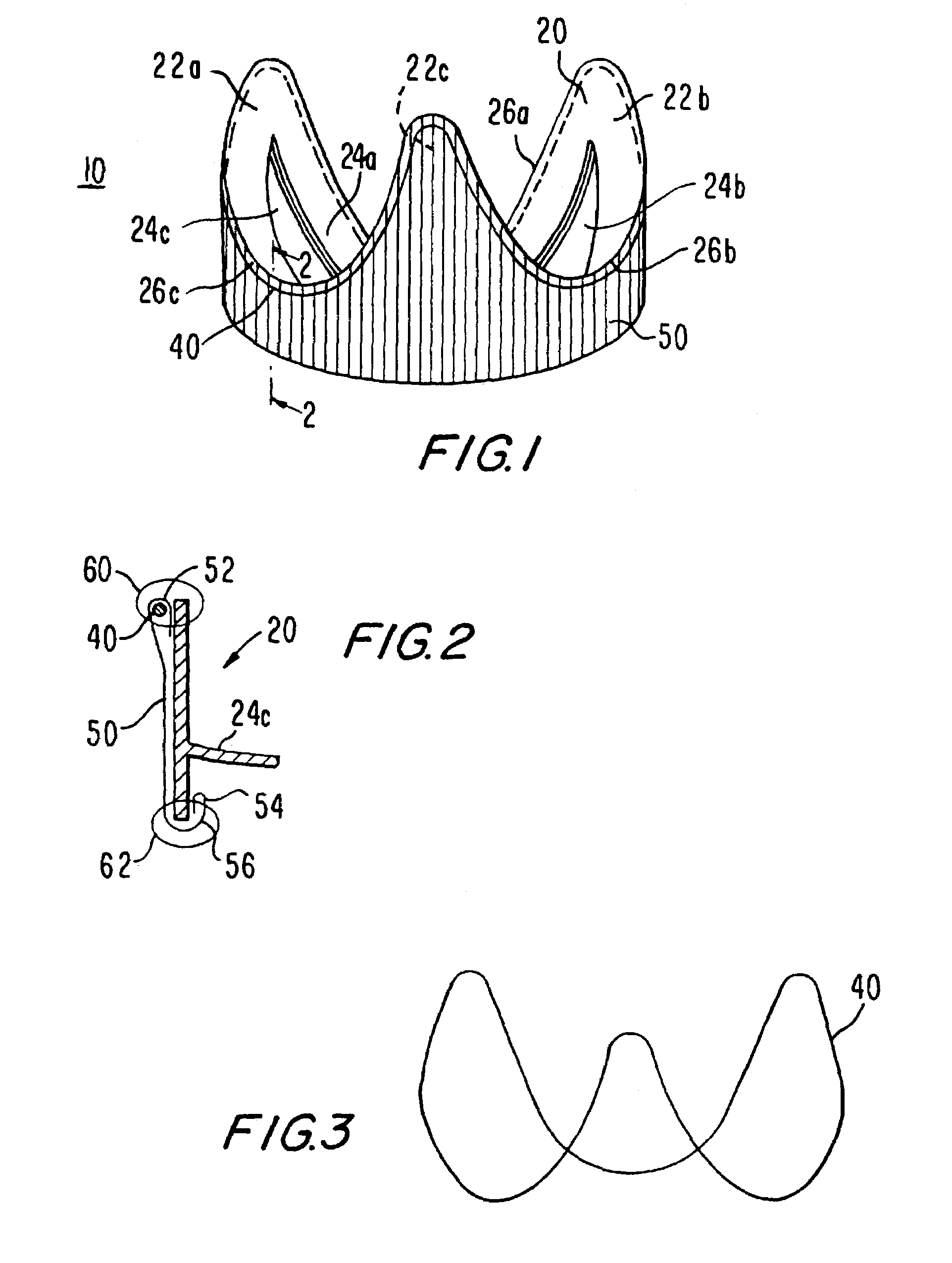 Heart valve structures