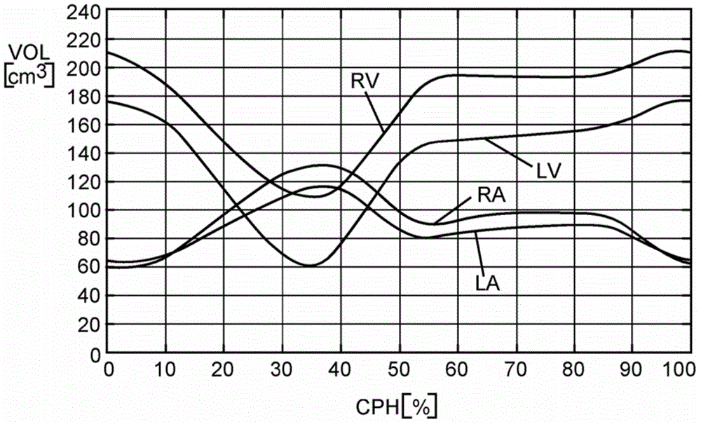 Method and apparatus for simulating blood flow under patient-specific boundary conditions derived from an estimated cardiac ejection output