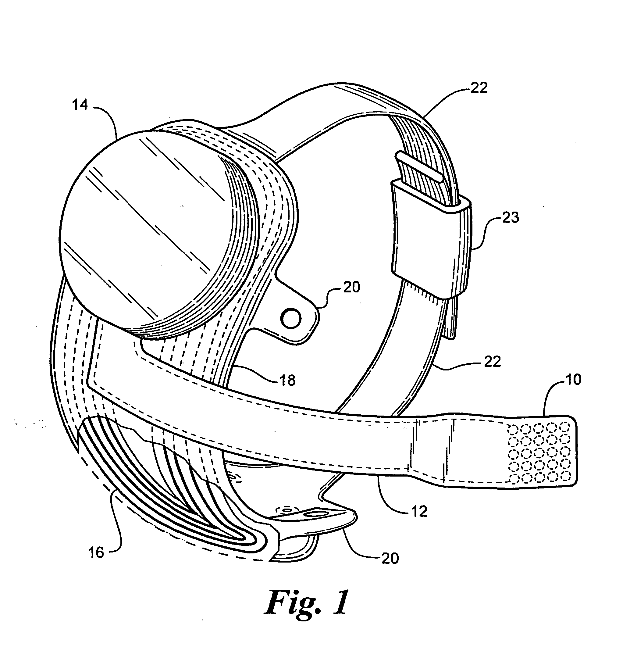 Retinal prosthesis