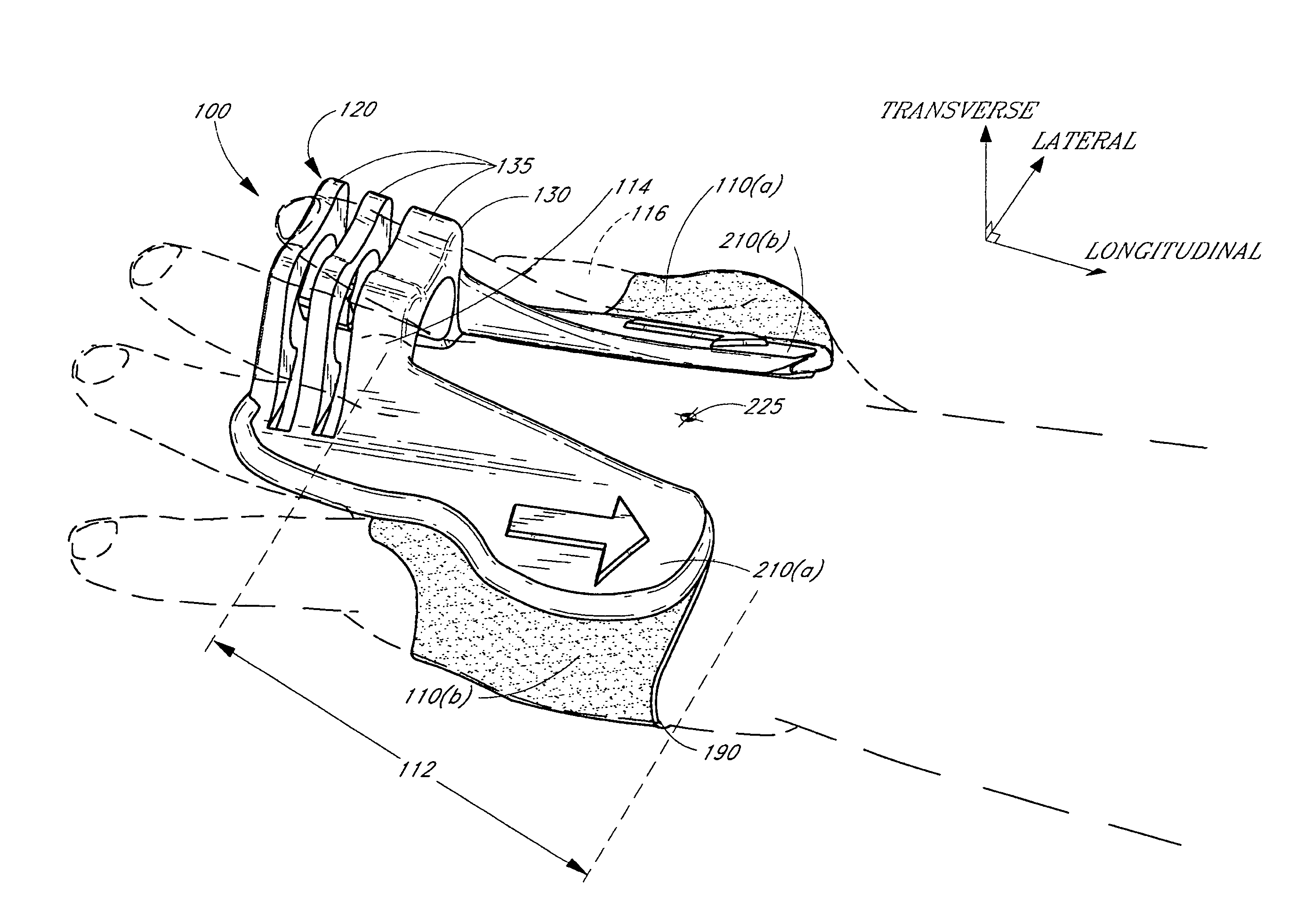 Anchoring system for use with neonates