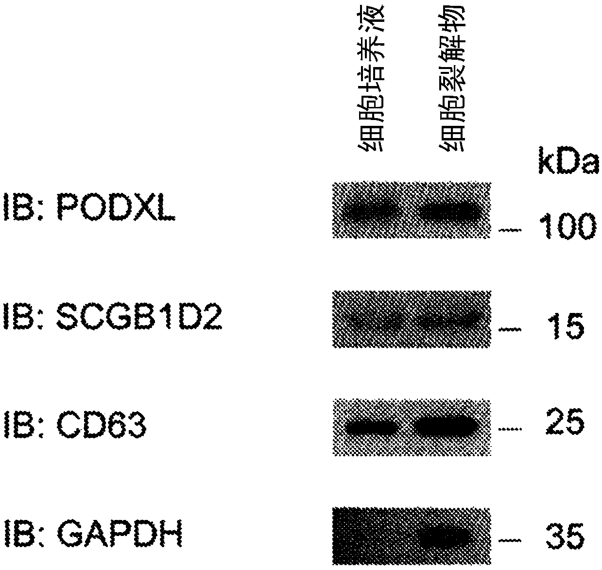 Marker for pancreatic cancer and intraductal papillary mucinous tumors