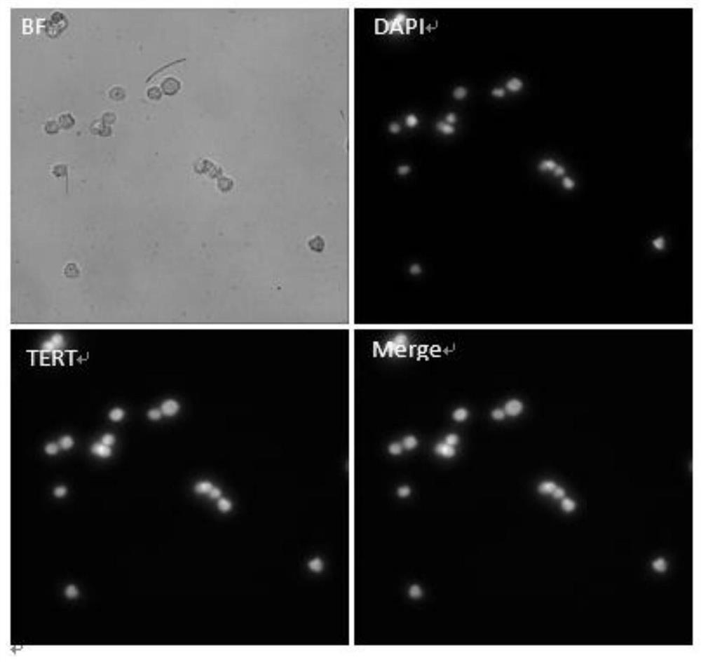 Marker combination and kit for detecting tumor cells in body fluid sample