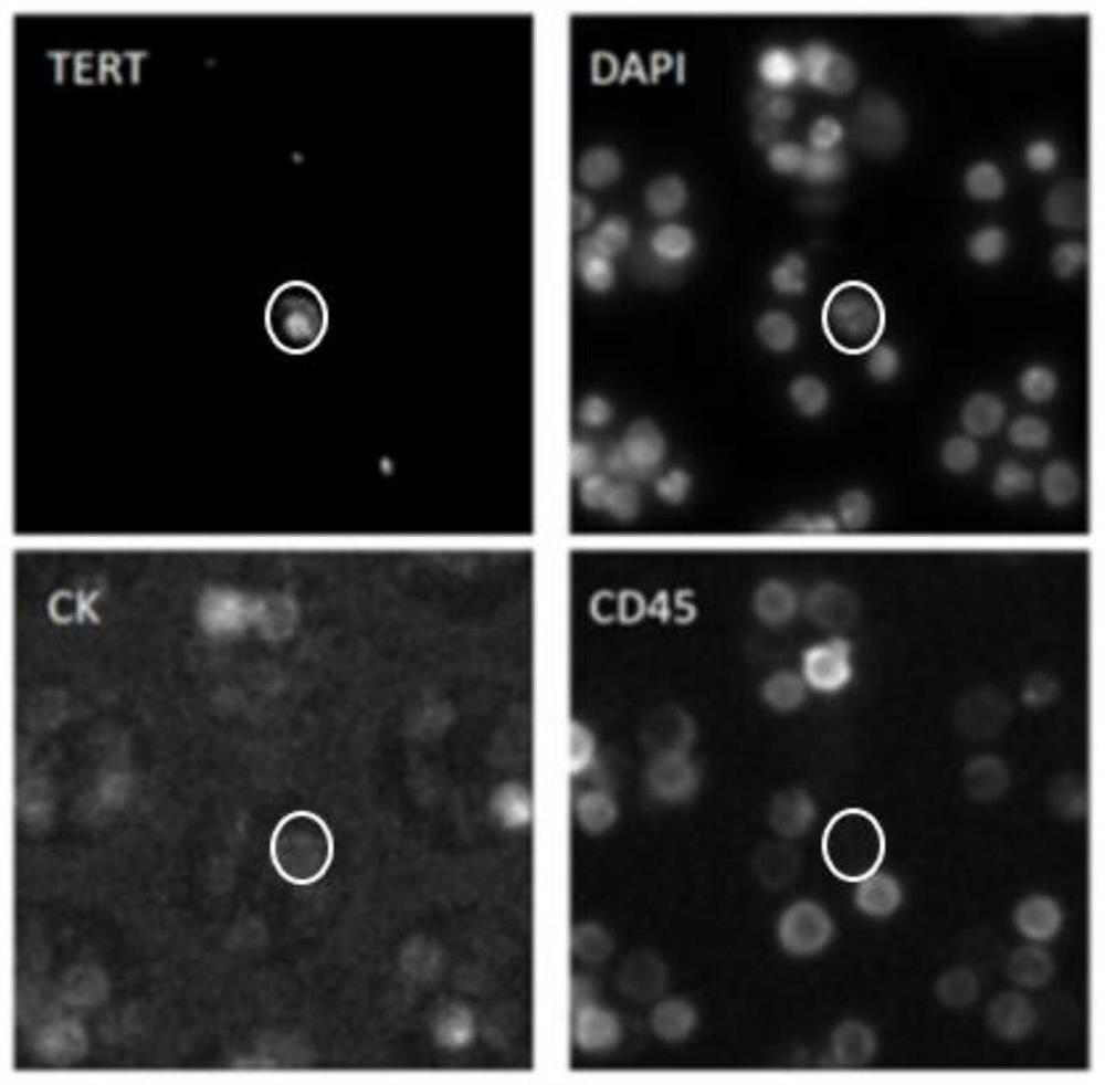 Marker combination and kit for detecting tumor cells in body fluid sample