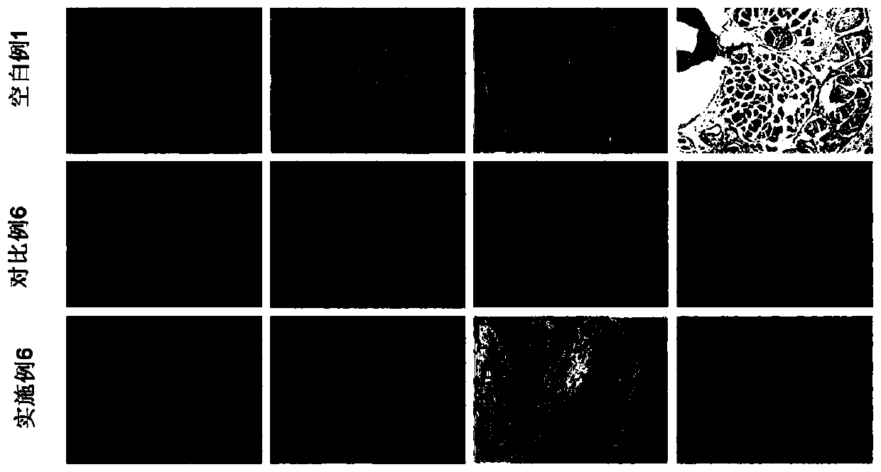 Cryoprotectant based on liquid metal nanoparticles as well as method and application of cryoprotectant