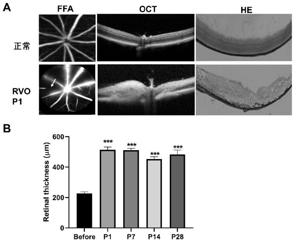 Novel retinal vein obstruction mouse model construction method