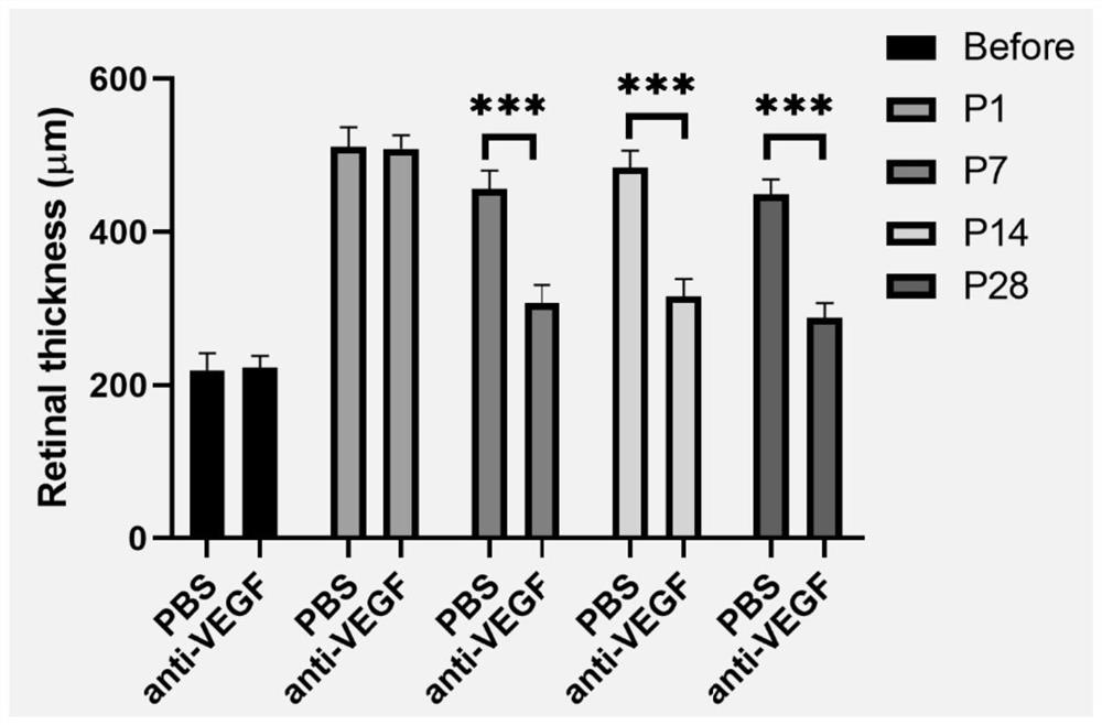 Novel retinal vein obstruction mouse model construction method