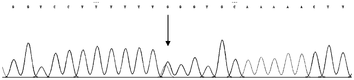 Detection kit for pathogenic gene CHD7 mutation of CHARGE syndrome