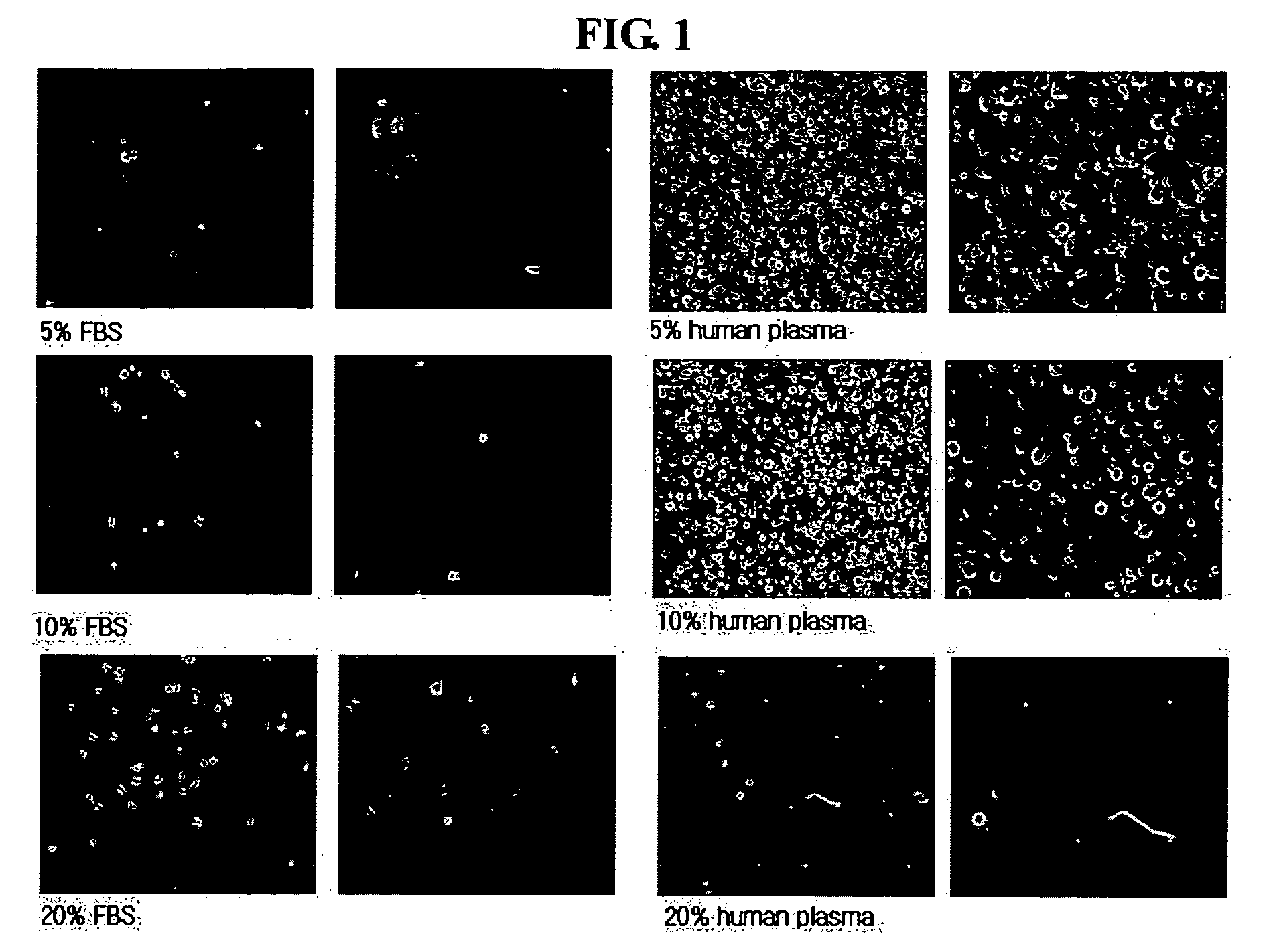 Multipotent stem cells isolated from umbilical cord blood and the cellular therapeutic agent comprising the same for treating ischemic disease