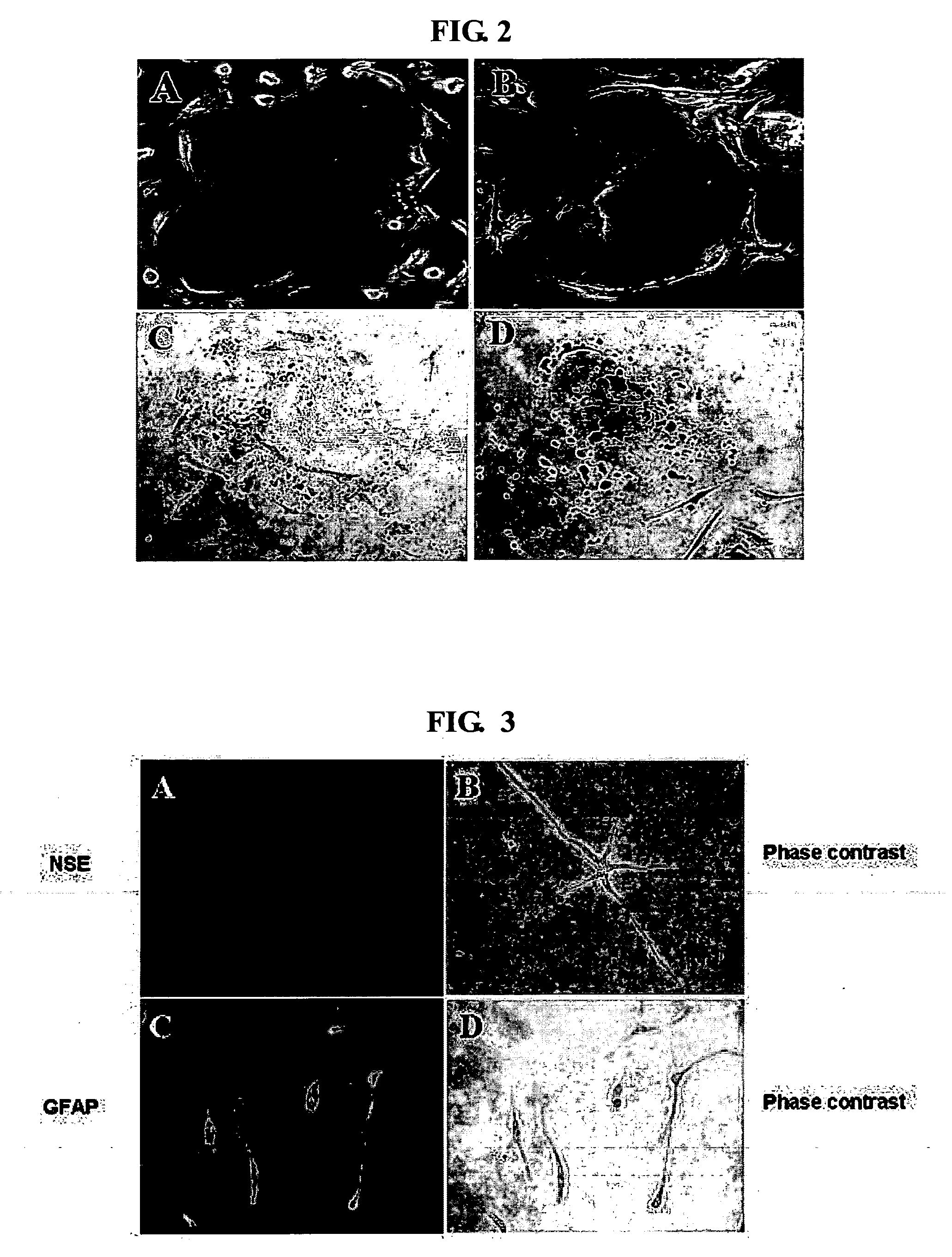 Multipotent stem cells isolated from umbilical cord blood and the cellular therapeutic agent comprising the same for treating ischemic disease