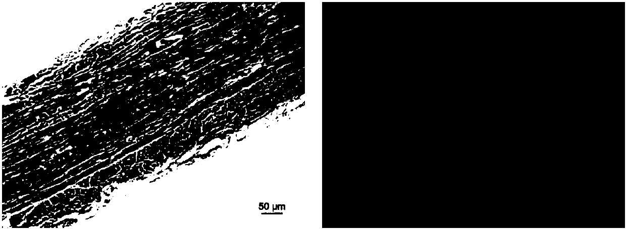 Preparation method of allogeneic biological patch