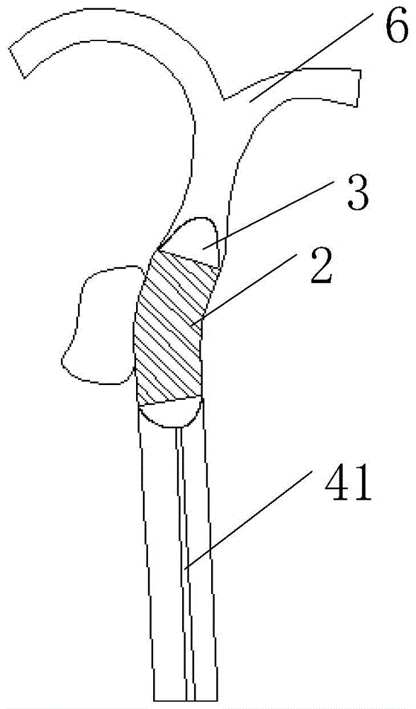 Degradable magnesium alloy membranous stent and membranous stent system