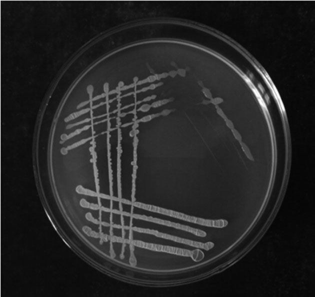 Bacillus subtilis and its application in dissolving phosphorus and inhibiting bacteria