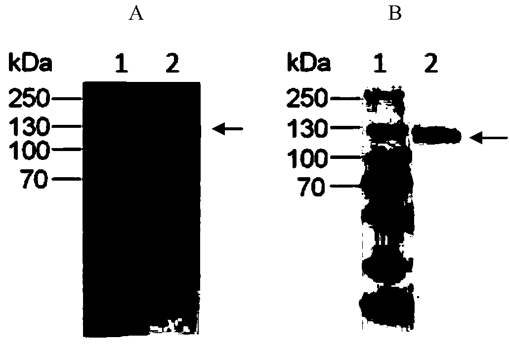 Anti-CD26 antibody and application thereof