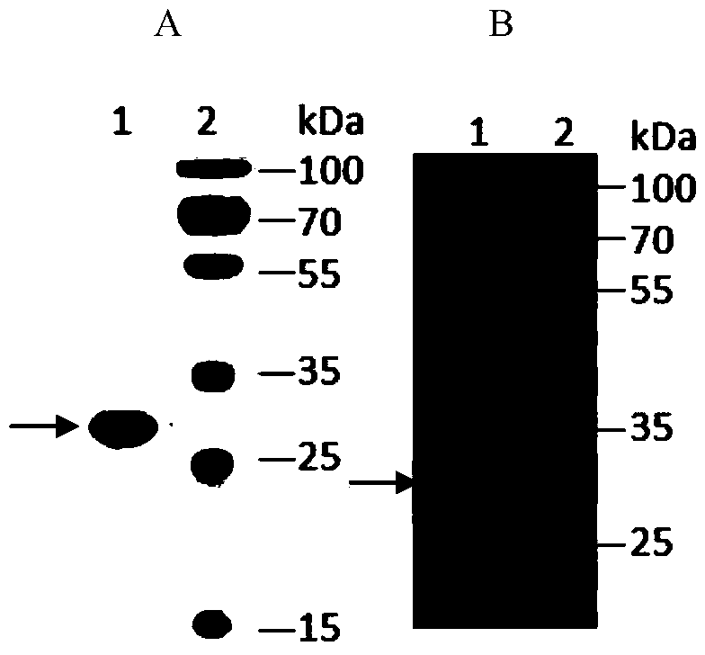 Anti-CD26 antibody and application thereof