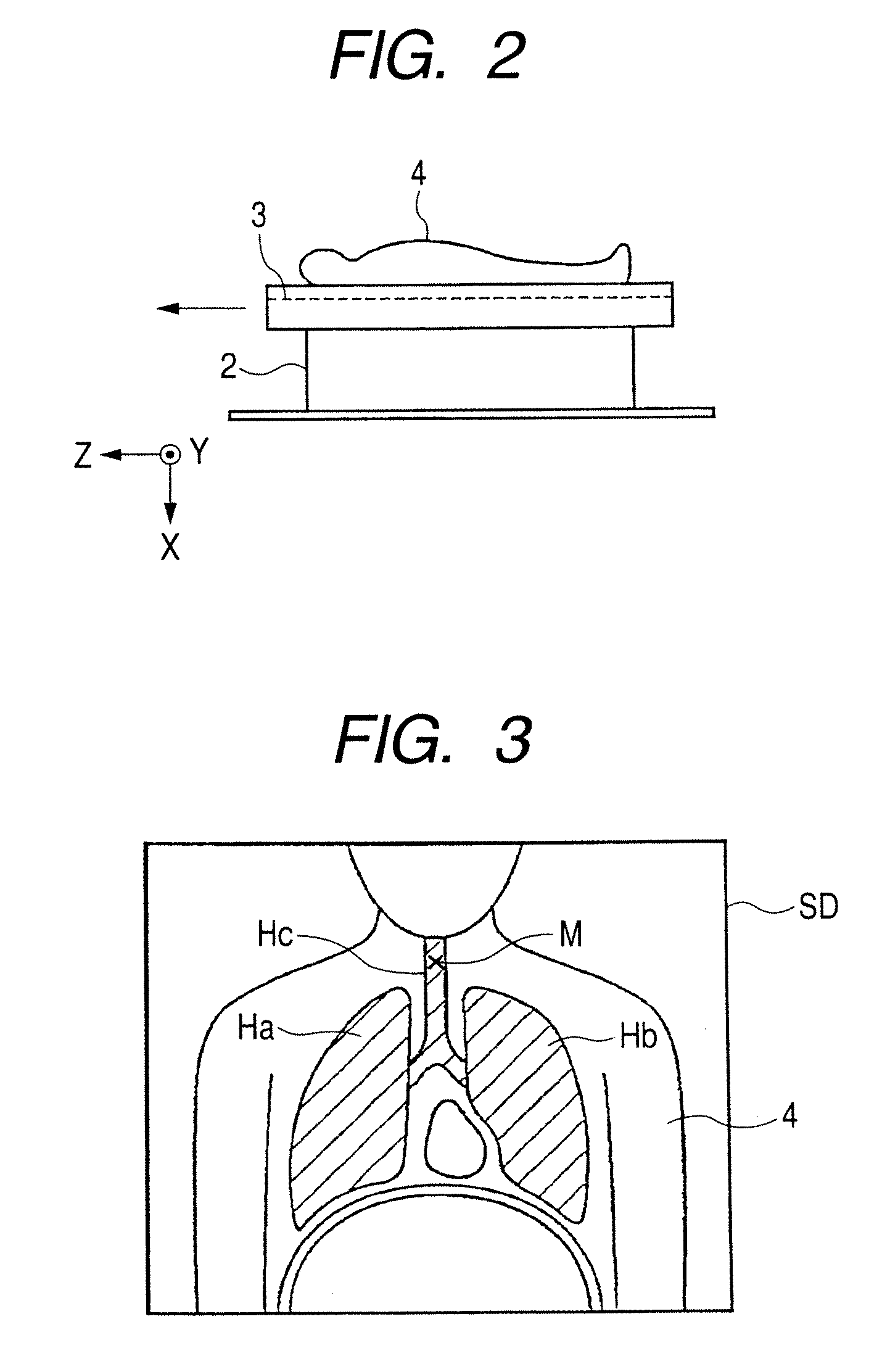 Medical image diagnosis apparatus, and x-ray ct apparatus, and image processor