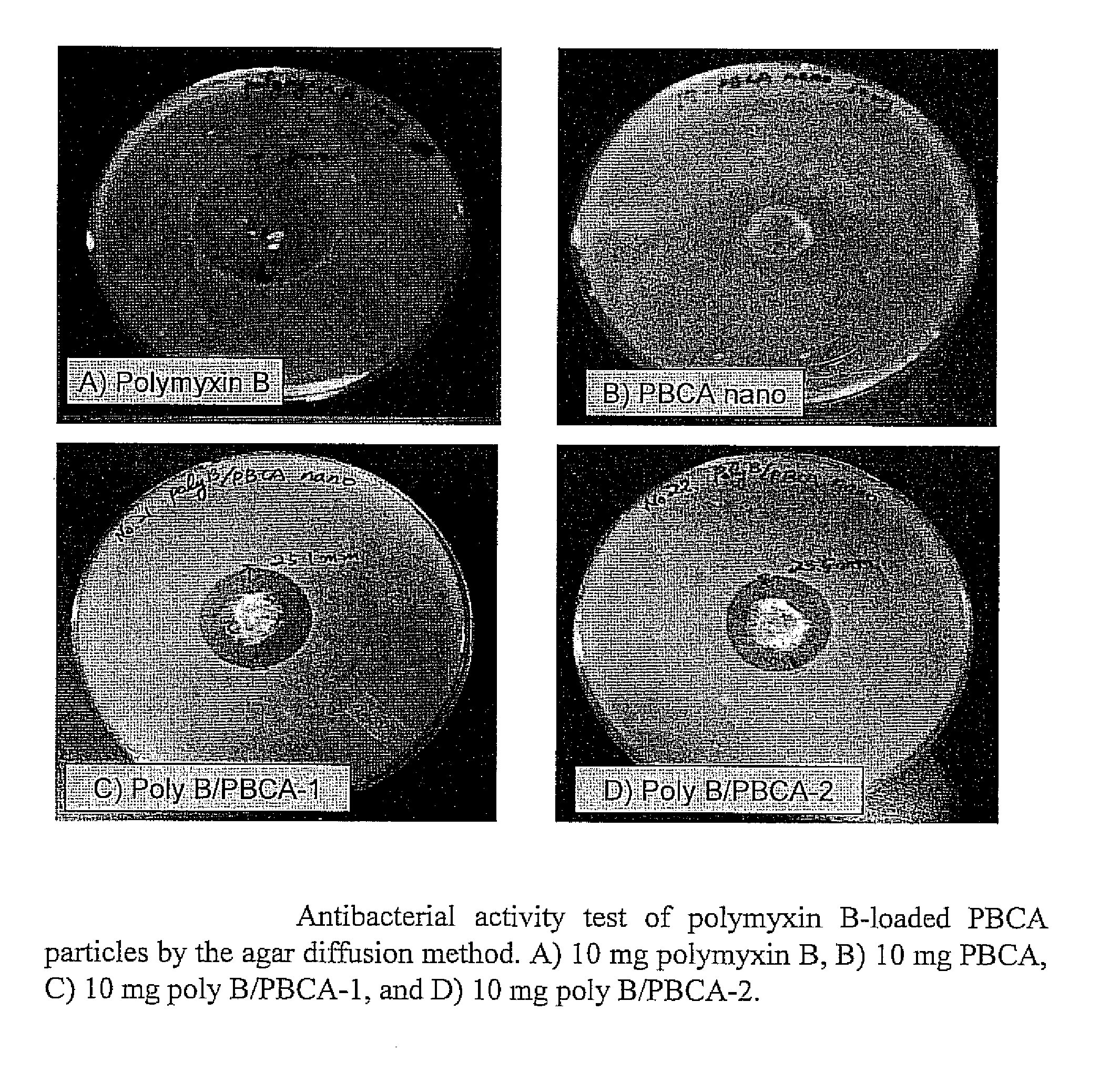 Cyanoacrylate tissue adhesives