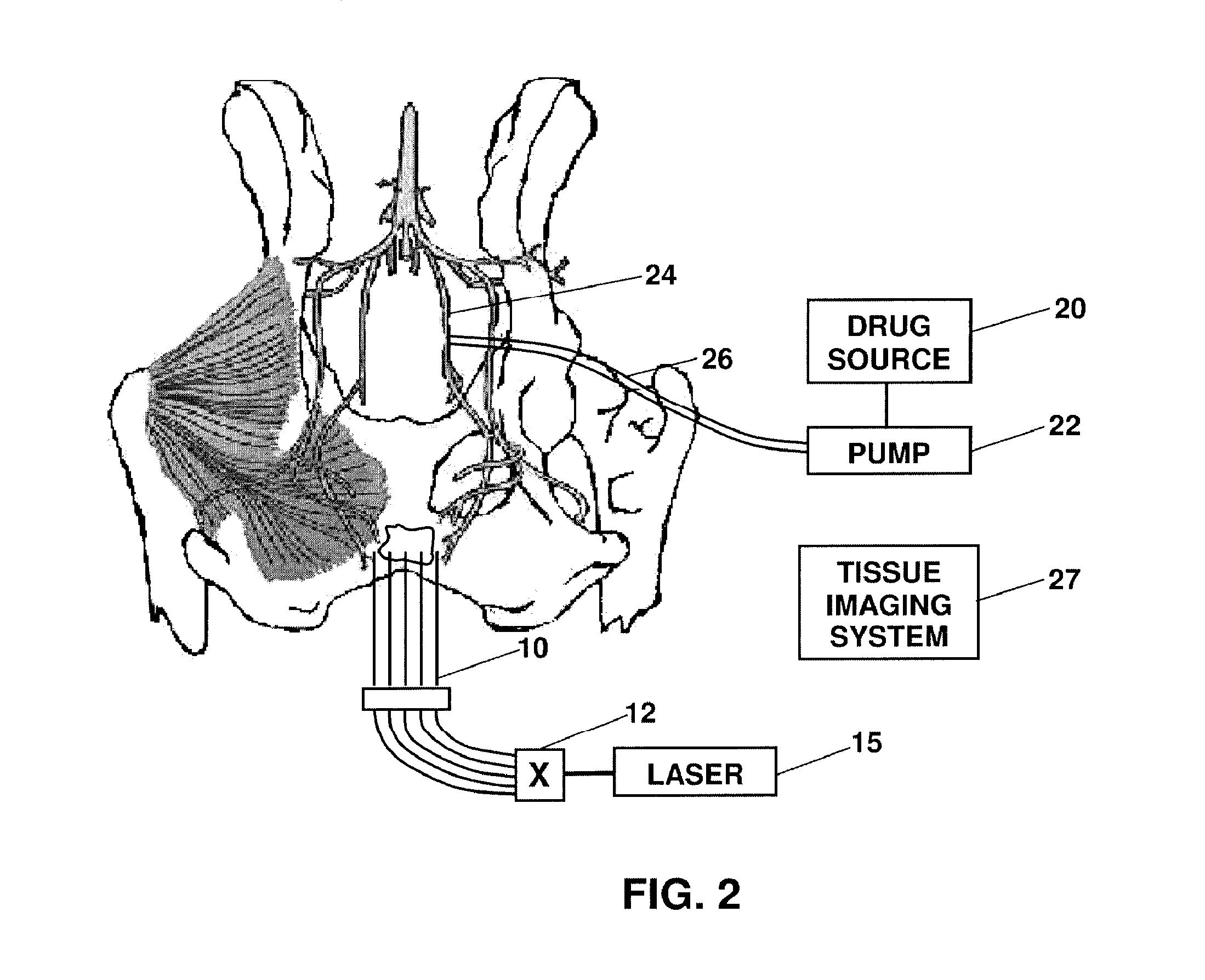 Switched photodynamic therapy apparatus and method