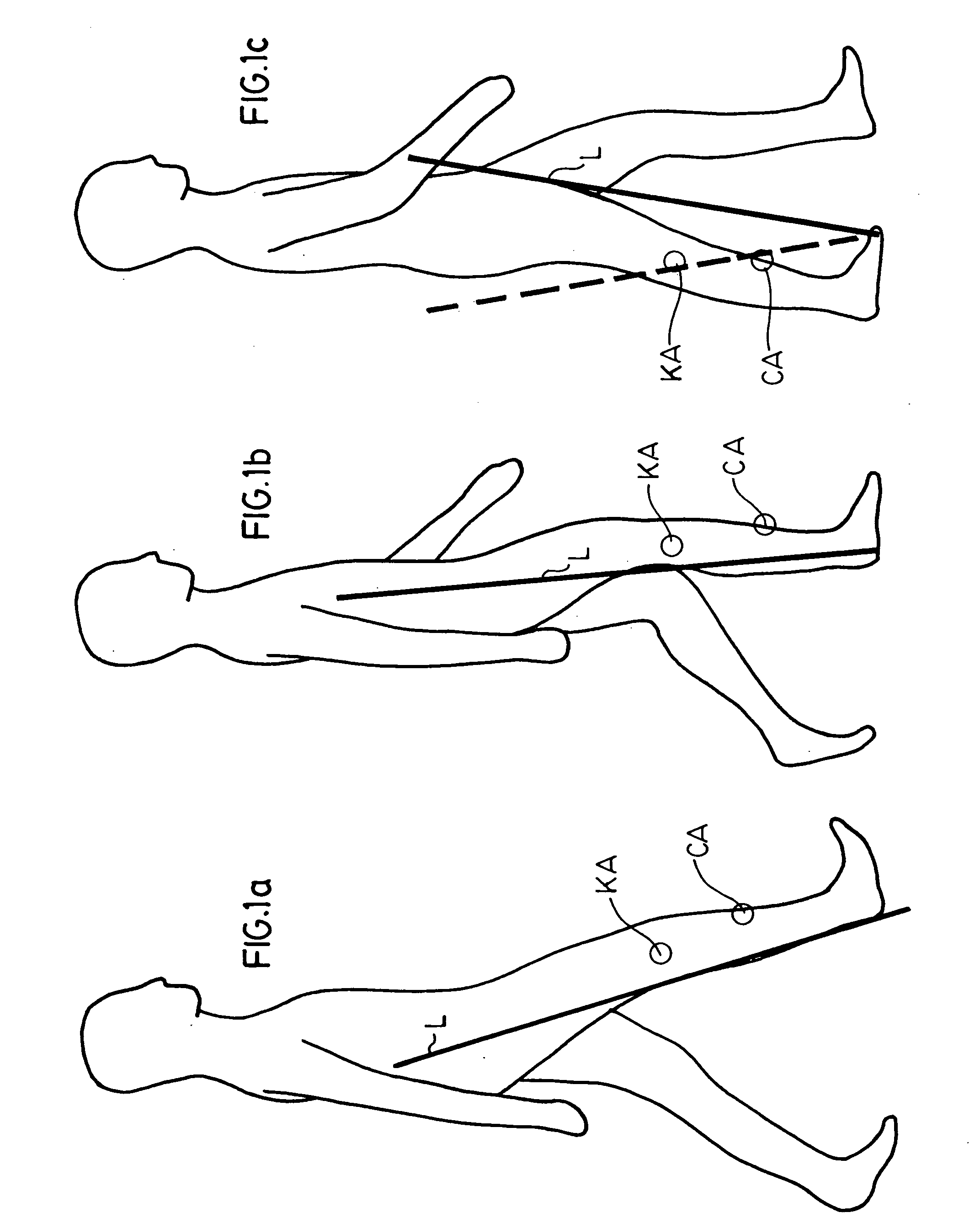 Artificial knee joint