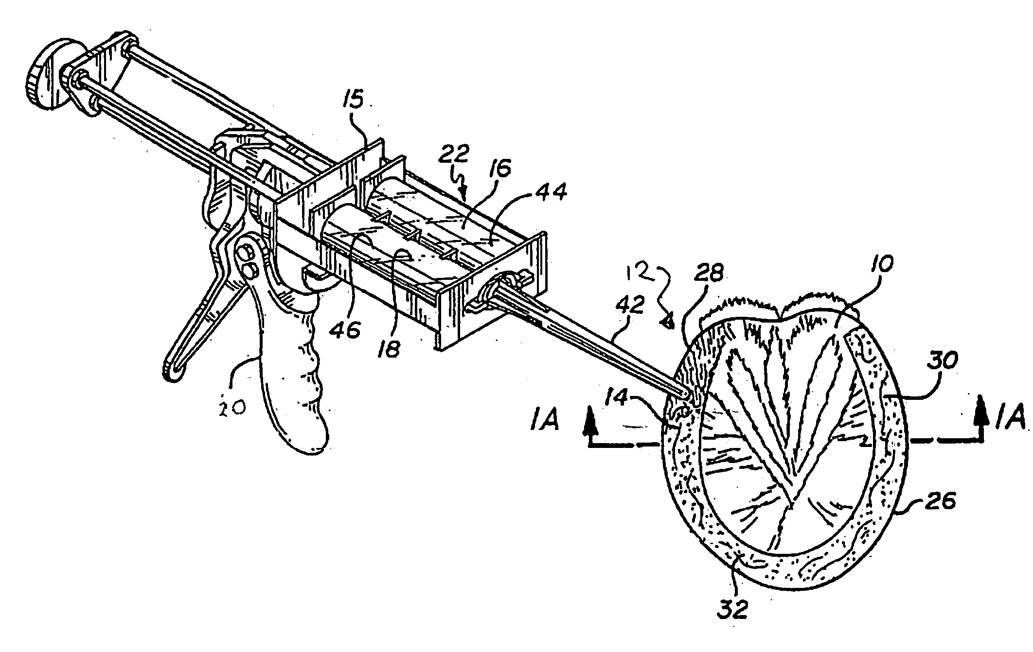 Method and apparatus for in situ and molded horseshoeing