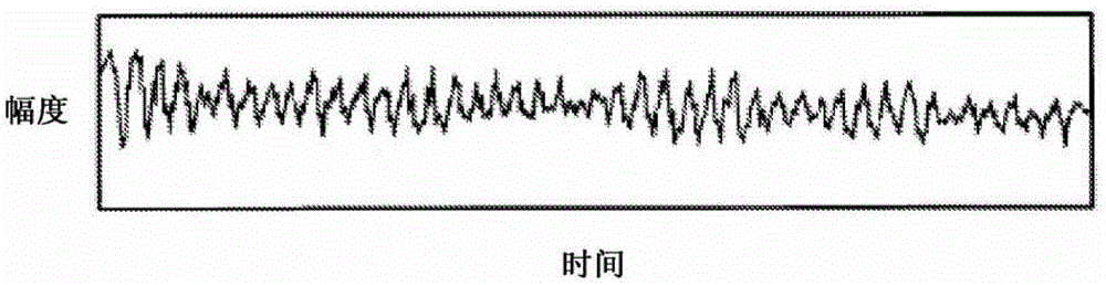 defibrillator monitor