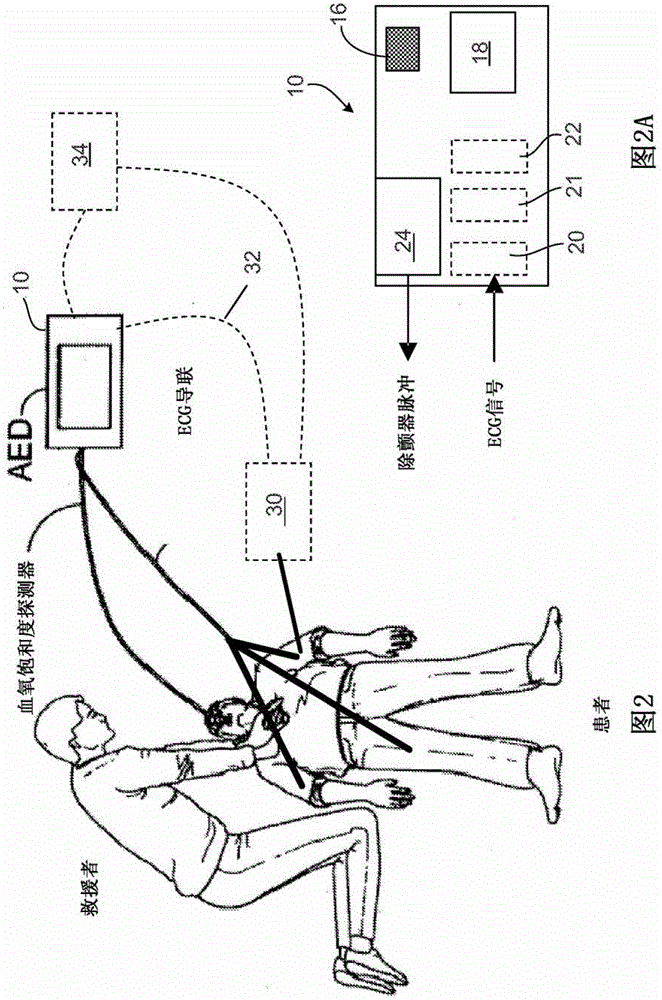 defibrillator monitor