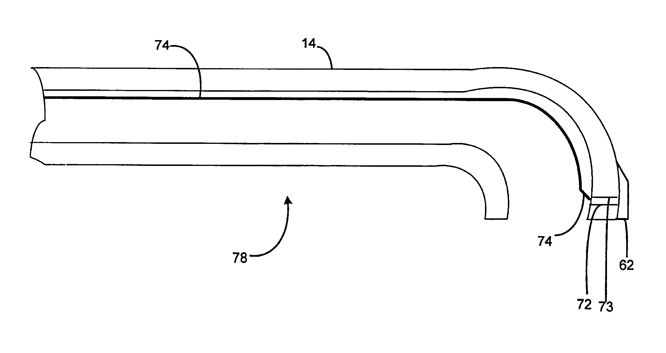 Regional anesthetic method and apparatus