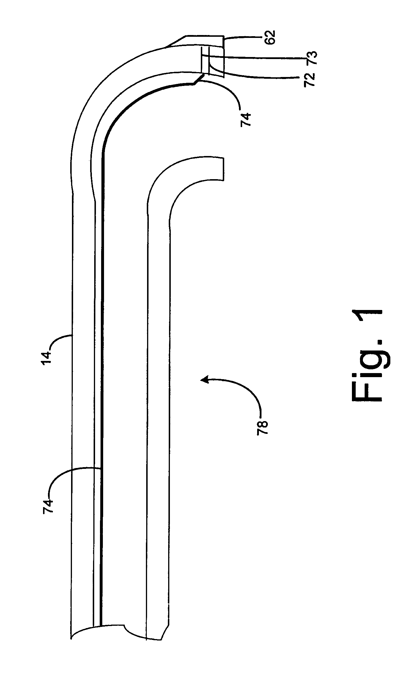 Regional anesthetic method and apparatus