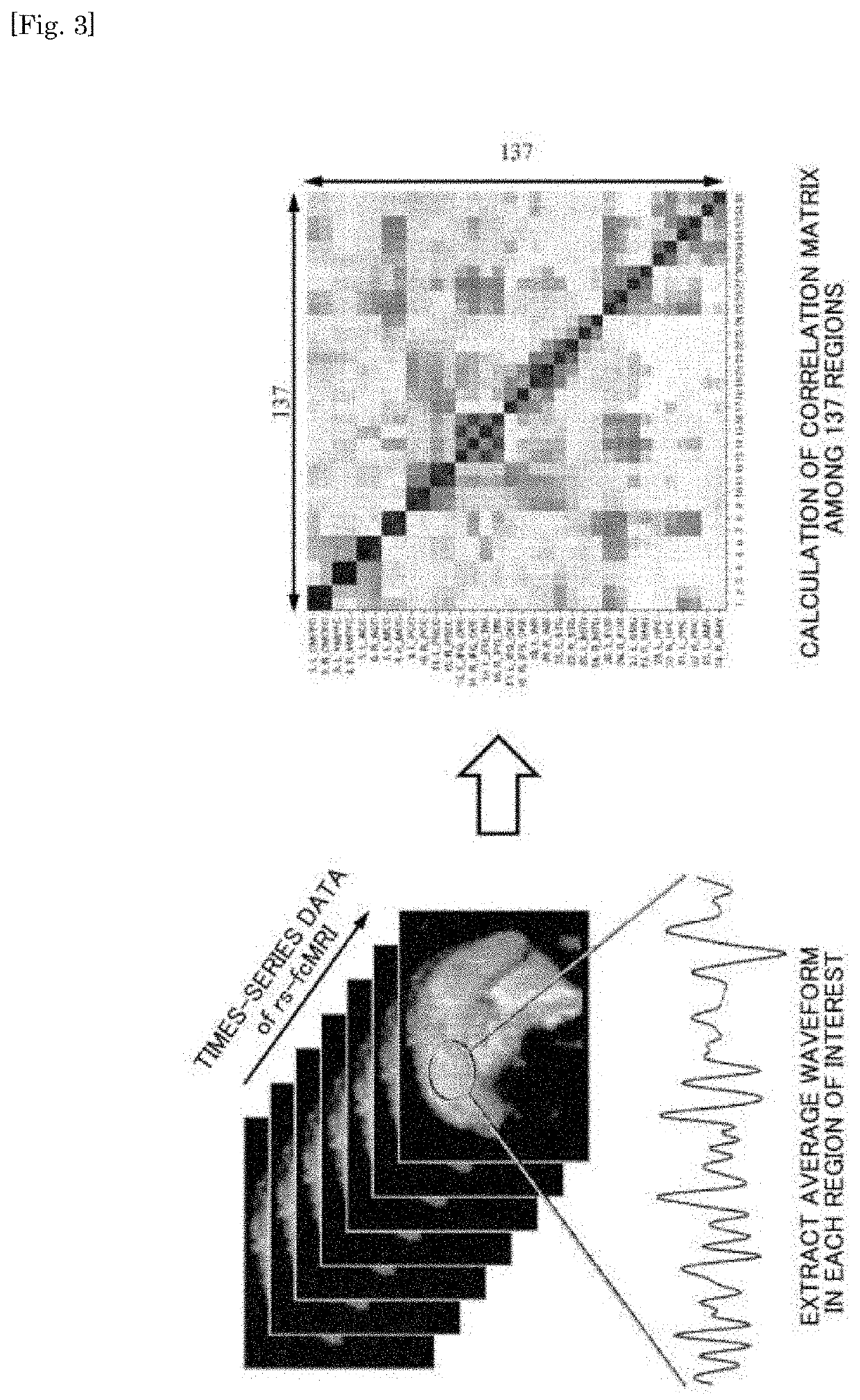 Differentiation device, differentiation method for depression symptoms, determination method for level of depression symptoms, stratification method for depression patients, determination method for effects of treatment of depression symptoms, and brain activity training device