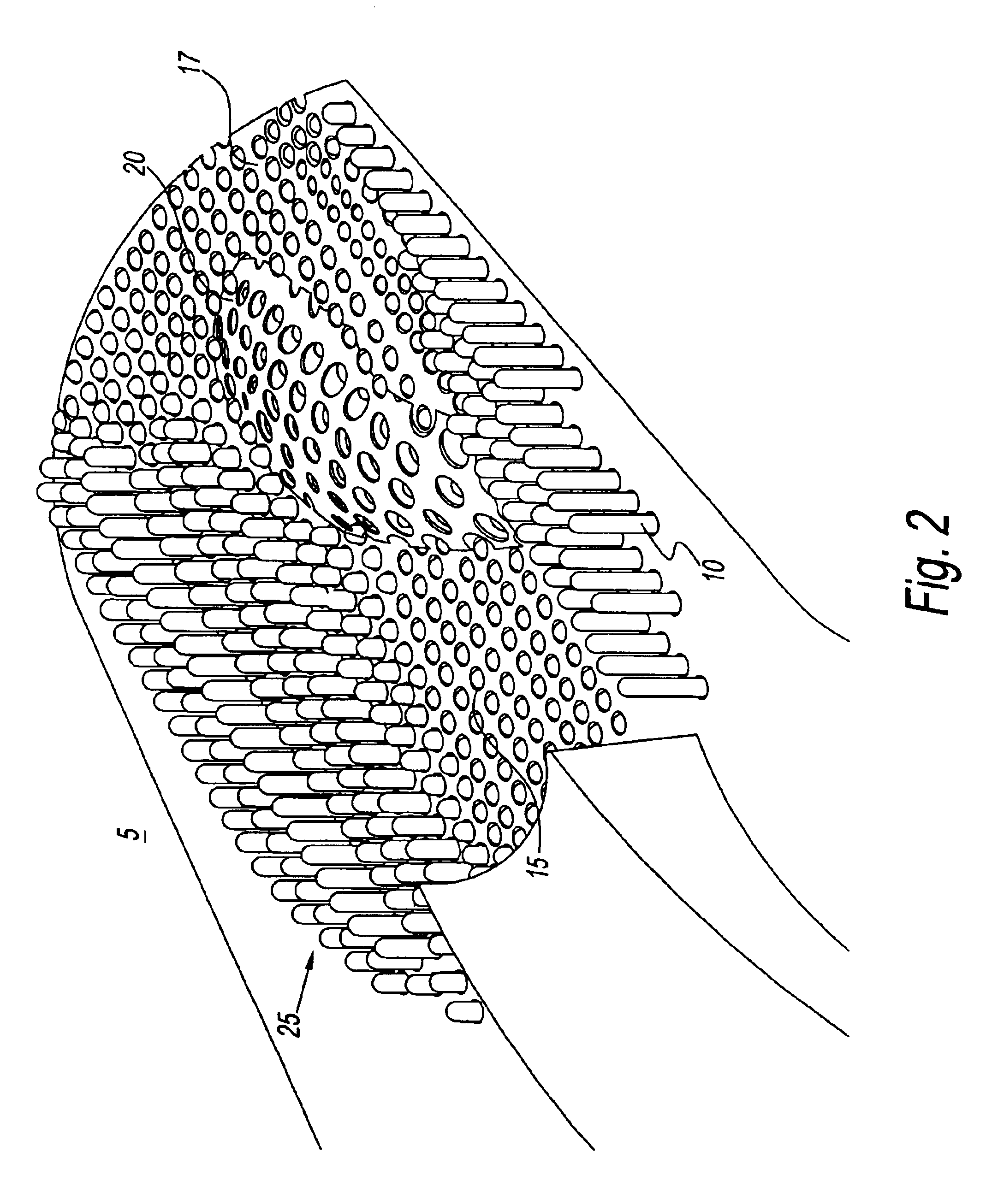 Method and system for capturing and supporting 3-D contour